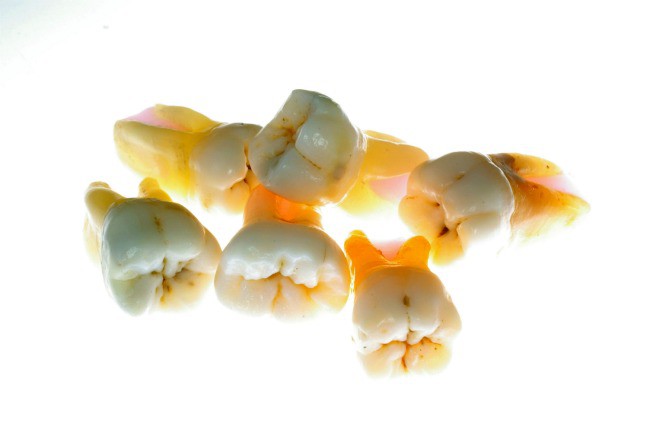 Set of upper and lower first molars