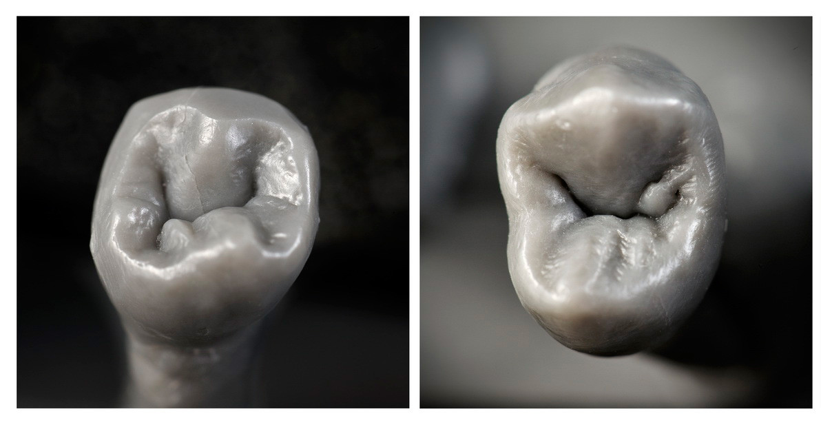 Set of upper and lower premolars